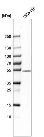 BTBD3 Antibody in Western Blot (WB)