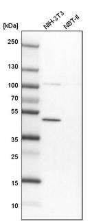 BTBD3 Antibody in Western Blot (WB)