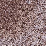 SNRNP70 Antibody in Immunohistochemistry (IHC)
