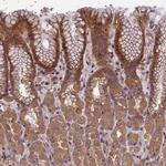 CHD9 Polyclonal Antibody