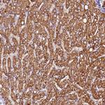 SIX5 Polyclonal Antibody