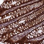 SIPA1L3 Polyclonal Antibody