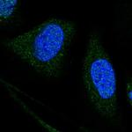 WDR7 Polyclonal Antibody