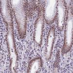 ZNF317 Antibody in Immunohistochemistry (IHC)