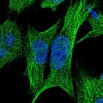 RPUSD2 Polyclonal Antibody