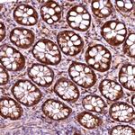 RPUSD2 Antibody in Immunohistochemistry (Paraffin) (IHC (P))