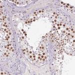 SYCE2 Polyclonal Antibody