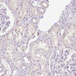 SYCE2 Antibody in Immunohistochemistry (IHC)