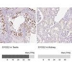 SYCE2 Antibody