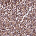 ZNF749 Antibody in Immunohistochemistry (IHC)