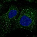 FBXW9 Polyclonal Antibody