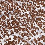 FBXW9 Antibody in Immunohistochemistry (Paraffin) (IHC (P))