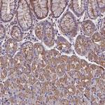 ZNF749 Polyclonal Antibody