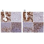 APOB48R Antibody in Immunohistochemistry (IHC)