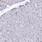 APOB48R Antibody in Immunohistochemistry (IHC)