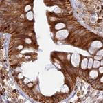 APOB48R Antibody in Immunohistochemistry (IHC)
