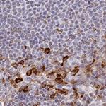 APOB48R Antibody in Immunohistochemistry (IHC)
