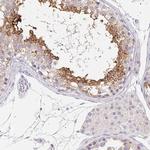 GLIPR1L1 Polyclonal Antibody