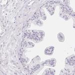 GLIPR1L1 Antibody in Immunohistochemistry (IHC)