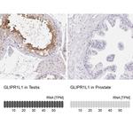 GLIPR1L1 Antibody