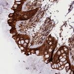 ARRDC4 Polyclonal Antibody