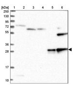 SOD3 Antibody in Western Blot (WB)