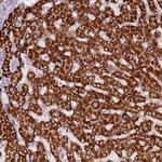 LGI4 Polyclonal Antibody