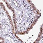 MRPL54 Antibody in Immunohistochemistry (IHC)