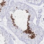 LRRC37A Antibody in Immunohistochemistry (Paraffin) (IHC (P))