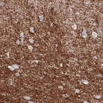 LRRC37A Antibody in Immunohistochemistry (Paraffin) (IHC (P))