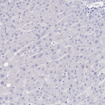 LRRC37A Antibody in Immunohistochemistry (Paraffin) (IHC (P))