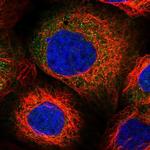 PPP2R2B Polyclonal Antibody