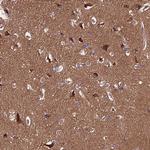 PPP2R2B Antibody in Immunohistochemistry (Paraffin) (IHC (P))