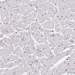 PPP2R2B Antibody in Immunohistochemistry (Paraffin) (IHC (P))