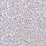PPP2R2B Antibody in Immunohistochemistry (Paraffin) (IHC (P))