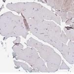 PPP2R2B Antibody in Immunohistochemistry (Paraffin) (IHC (P))