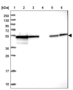PPP2R2B Antibody in Western Blot (WB)