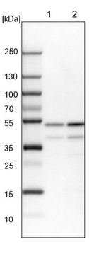 PPP2R2B Antibody in Western Blot (WB)