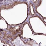 RSBN1 Antibody in Immunohistochemistry (Paraffin) (IHC (P))