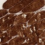 ZNF417 Polyclonal Antibody