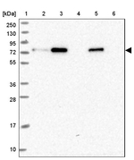 ZNF417 Antibody in Western Blot (WB)