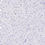 PRR4 Antibody in Immunohistochemistry (Paraffin) (IHC (P))