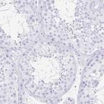 PRR4 Antibody in Immunohistochemistry (Paraffin) (IHC (P))