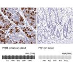 PRR4 Antibody in Immunohistochemistry (IHC)