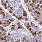 PRR4 Antibody in Immunohistochemistry (IHC)