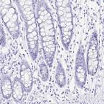 PRR4 Antibody in Immunohistochemistry (IHC)