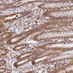DDA1 Polyclonal Antibody