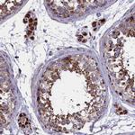 SLC39A3 Antibody in Immunohistochemistry (Paraffin) (IHC (P))