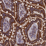SLC39A3 Antibody in Immunohistochemistry (Paraffin) (IHC (P))