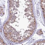 IZUMO2 Polyclonal Antibody